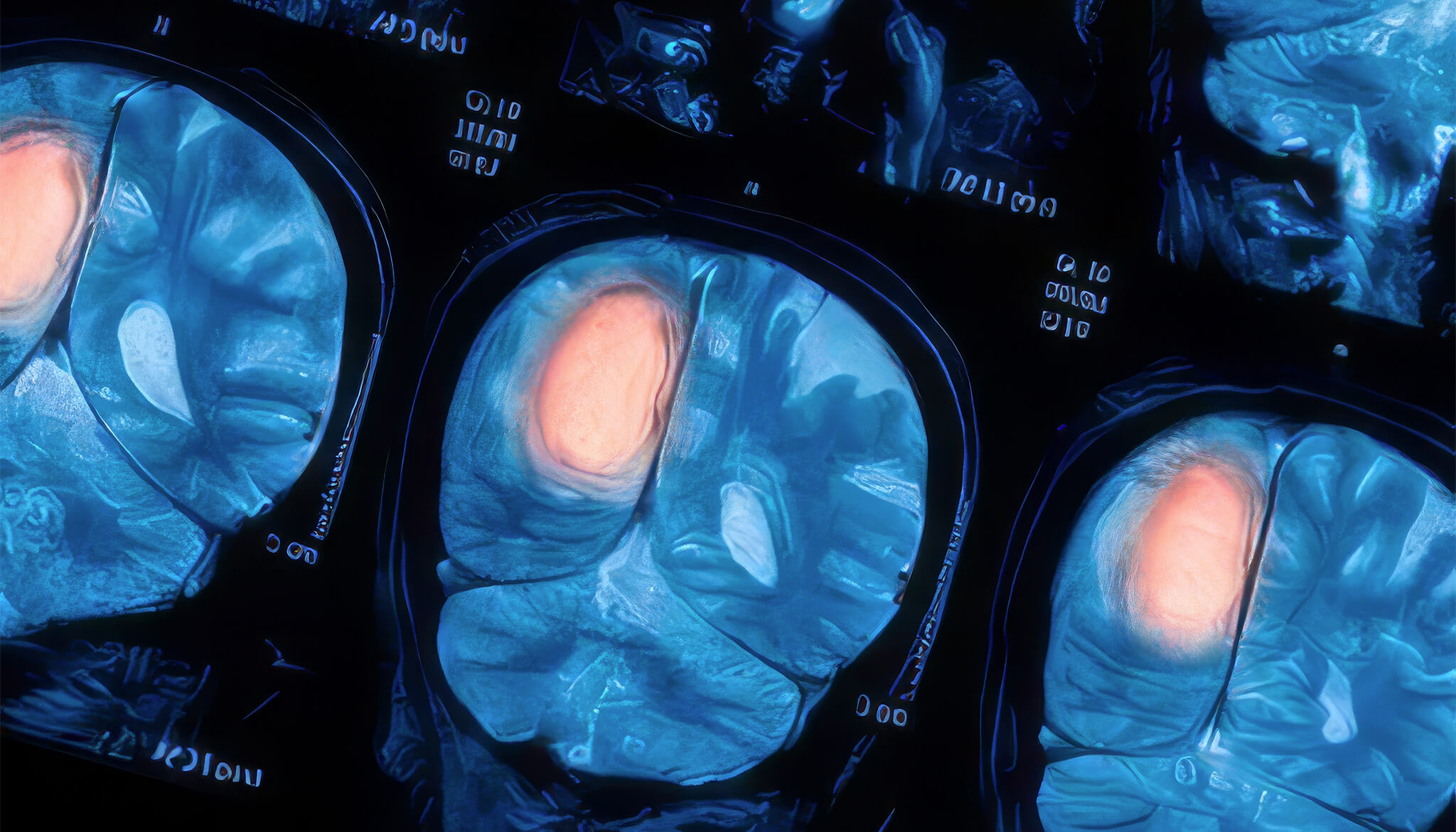 Cancer Medicine Should Not Have an Age Order