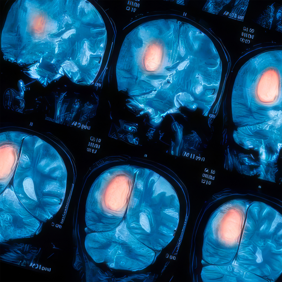 Cancer Medicine Should Not Have an Age Order